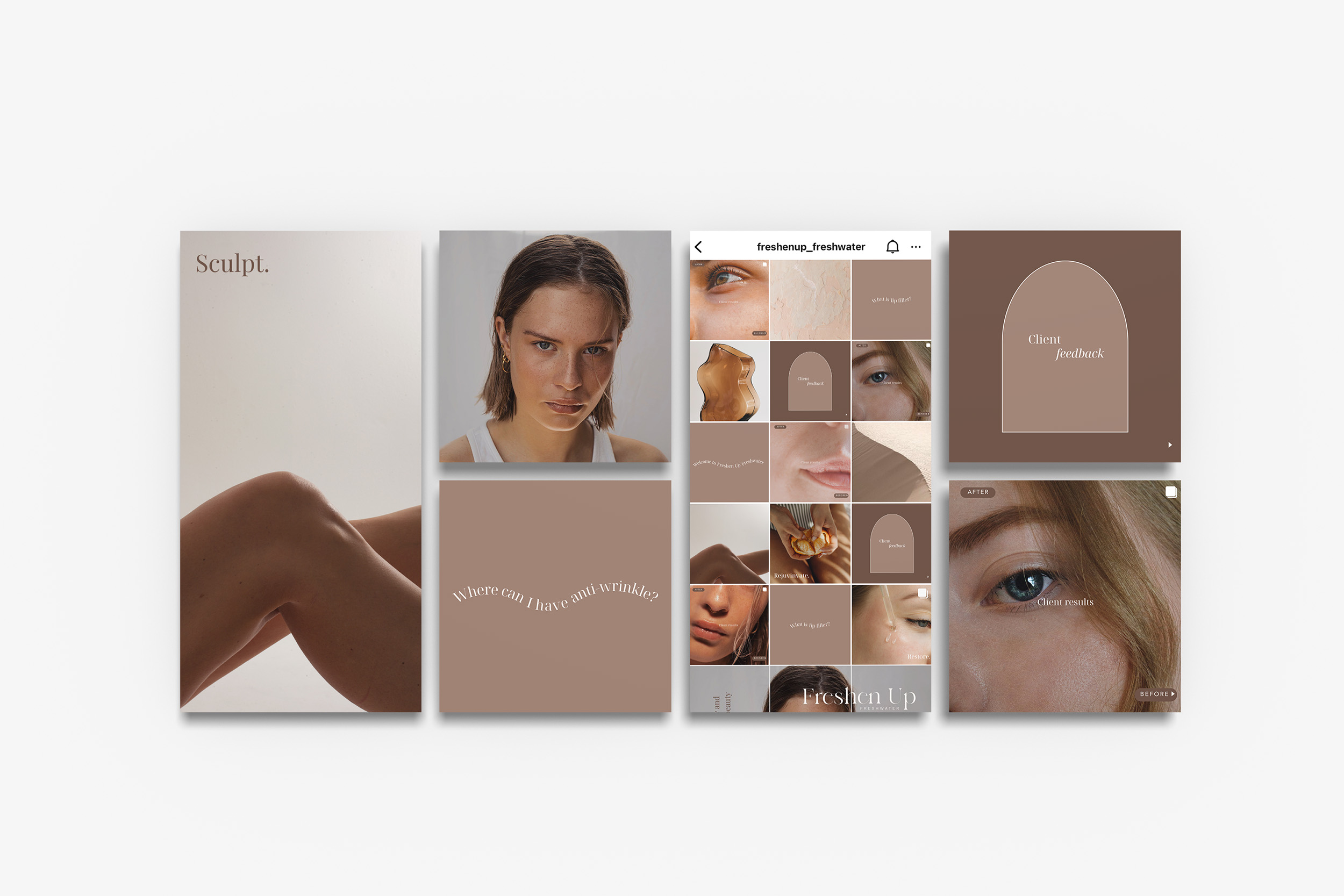 instagram feed mockup for a cosmetic injectables clinic